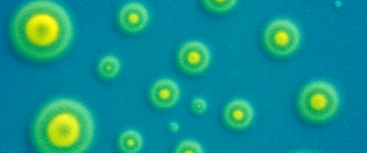 Taking Control of Mycoplasma: A Complete 3-Step Lab Solution