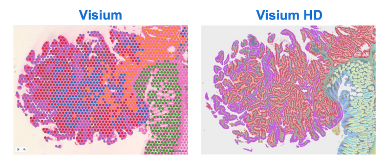 Visium HD Spatial Gene Expression: Revolutionizing Biological Insights