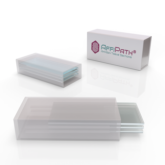 AffiPATH®